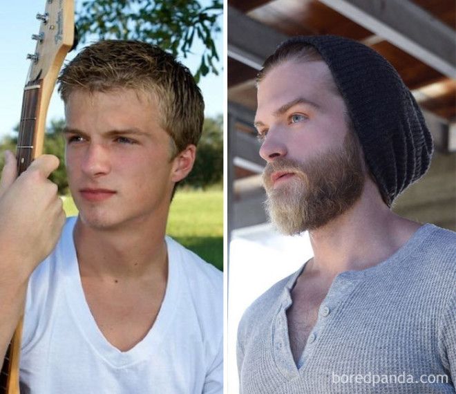 Before And After Growing A Beard