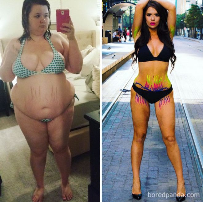 20 Before and After Photos Show Incredible Weight Loss Transformations