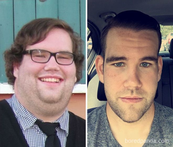 20 Before and After Photos Show Incredible Weight Loss Transformations