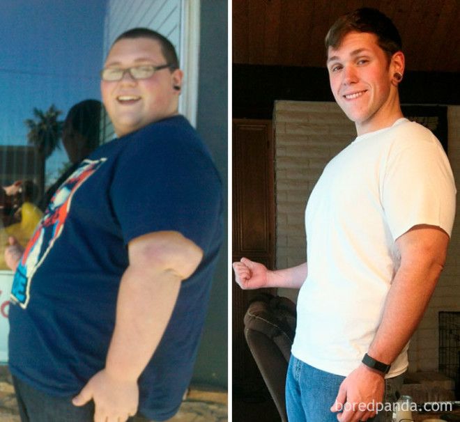 20 Before and After Photos Show Incredible Weight Loss Transformations