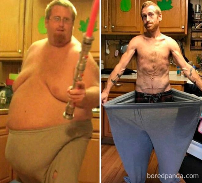 20 Before and After Photos Show Incredible Weight Loss Transformations