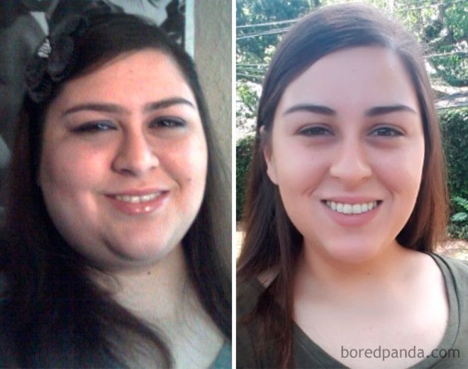 20 Before and After Photos Show Incredible Weight Loss Transformations