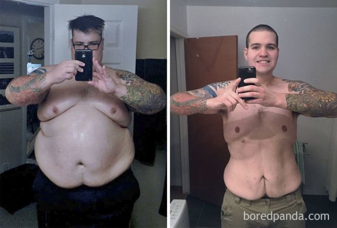 20 Before and After Photos Show Incredible Weight Loss Transformations