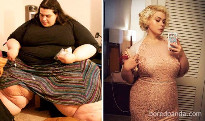 20 Before and After Photos Show Incredible Weight Loss Transformations