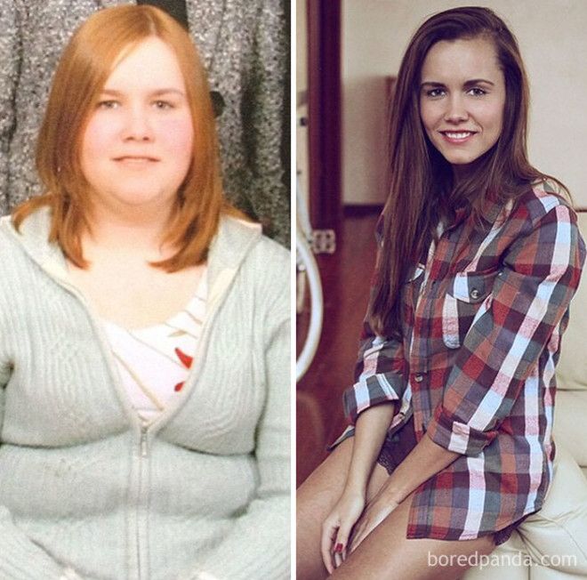 20 Before and After Photos Show Incredible Weight Loss Transformations