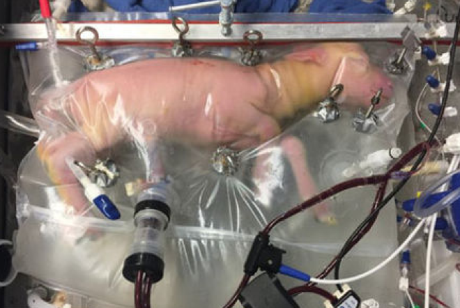 Researchers created a firstofitskind artificial womb that could one day help premature babies grow