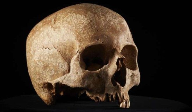 A Roman skull, uncovered by archaeologists during the expansion of the London Underground.