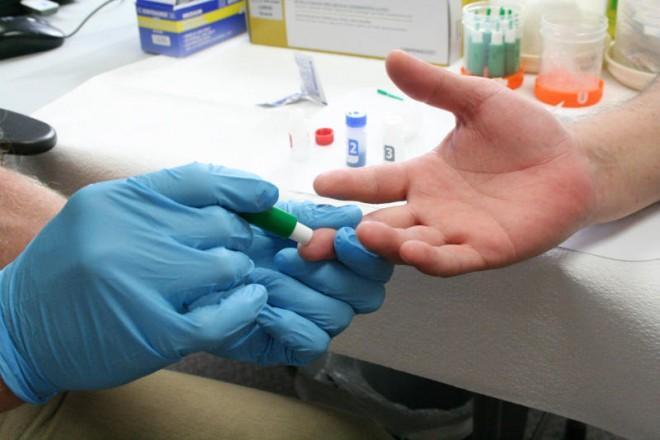 Without using a needle